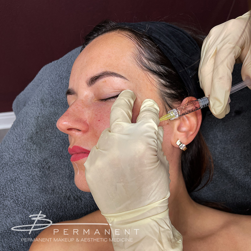 skin-aesthetic-medicine-clinic-near-me-preston-mesotherapy-skin-boosters-xela-rederm-hyaluronic-acid-injections-injectables-redermalisation-results-before-&-after-lancashire-pic-1
